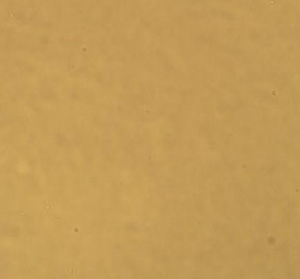 Gelių su metronidazoliu mikroskopavimo nuotraukos pateiktos 7 pave