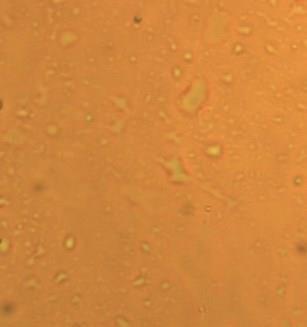 Gelių mikrokopinis vaizdas; A kontrolinis gelis; B Gelis su metronidazoliu; C,,Rozex ; D,,Metrogel Iš