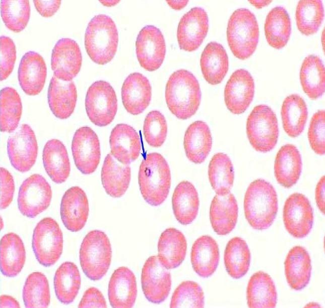 Kraujo tepinėlis dažomas Romanovskio Gimzos metodu (Šarkūnas, 2005). Mikroskopuojant eritrocitai matomi rožiniai, o juose esančios babezijos mėlynos (3 ir 4 pav.). Jos gali būti randamos ir kraujo plazmoje (Šarkūnas, Šarkūnas, 2004).
