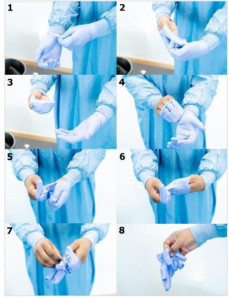 8 14 pav. Pirštinių nuėmimas (1-8 žingsniai) Nuėmus pirštines, būtina atlikti rankų higieną ir užsidėti naują porą pirštinių, kad būtų galima toliau tęsti nusirengimo procedūrą.