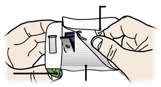 J 3 etapas: Atlikite injekciją Nulupkite abu žalius nuplėšiamuosius lapelius, pasirodys prie odos klijuojama dalis. Automatinis mini dozatorius yra įjungtas, jei mirksi mėlyna būsenos lemputė.