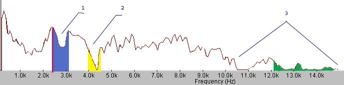 54 m. vyro K.D. spektrogramos pateiktos 9.1 9.2 pav. 9.1 pav. Ligonio K.D (54 m.) spektrograma. Antra juosta.