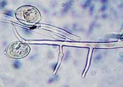 Parazito grybiena išsiraizgo lapo tarpuląsčiuose, vėliau pro žioteles į lapo išorę išaugina nelytinio dauginimosi struktūras sporanges ant monopodiniu būdu šakotų sporangėkočių.