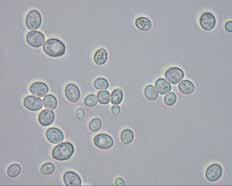 Eilė Saccharomycetales mieliagrybiečiai Somatinį kūną paprastai sudaro pavienės ląstelės, rečiau septuoti hifai.