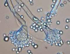 Laboratorinių darbų metu nagrinėjami eurotiečiai iš dviejų ekonomiškai svarbių anamorfinių grybų genčių galvenio (Aspergillus) ir pelėjūno (Penicillium) genčių. Aspergillus sp. galvenis (17 pav.