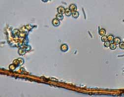 70 pav. Karpotasis pumpotaukšlis (Lycoperdon perlatum): papėdsporės ir kapiličio siūlas (I.