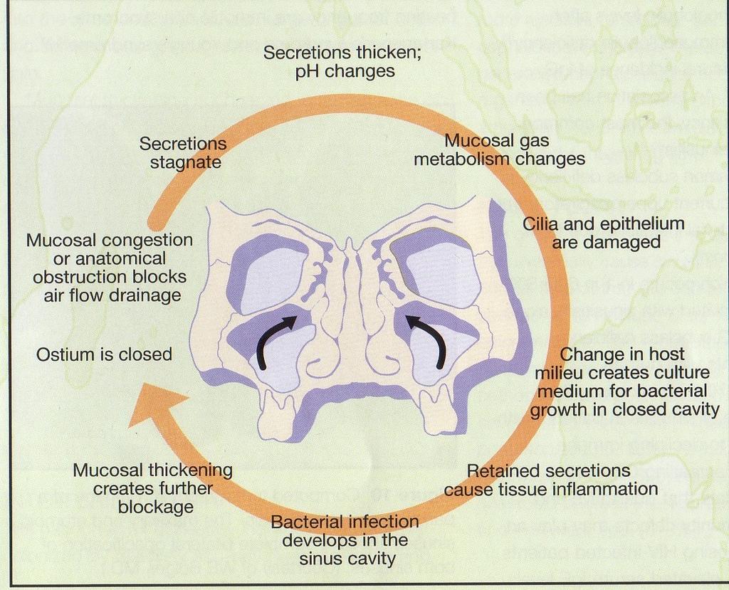 PATOLOGINĖ FIZIOLOGIJA Nosies angų obstrukcija ir mukociliarinio transporto sutrikimas pagrindiniai veiksniai