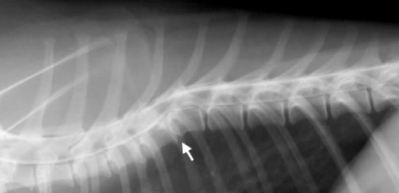 patempiamos kaudaliai. Krūtinės stuburo sritis sulygiuojama su viršutine rentgenogramos horizontaliąja linija.