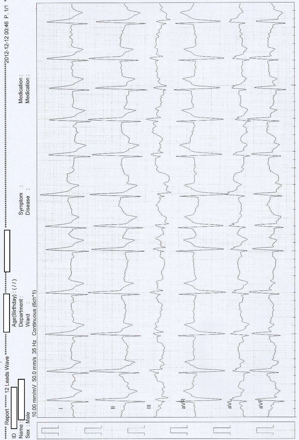 5 priedas. EKG pavyzdys Šuo, bokseris,, 7 m. Širdies susitraukimų dažnis 127 189 kart.