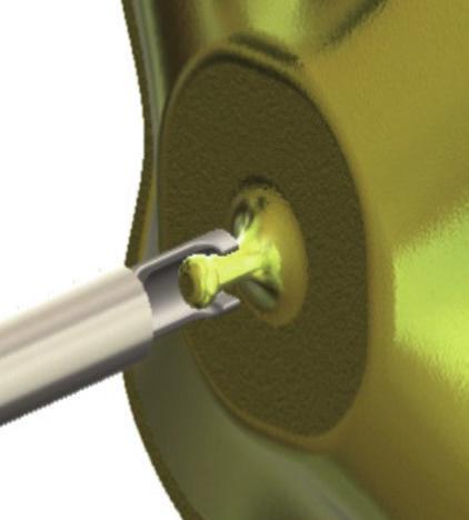Flex Pusher: distal part PLD: proximal side welded hub Fig. 4.