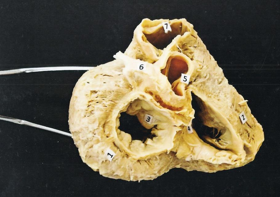 1. Ventriculus dexter 2. Ventriculus sinister 3. Valva bicuspidalis (mitralis) 4.