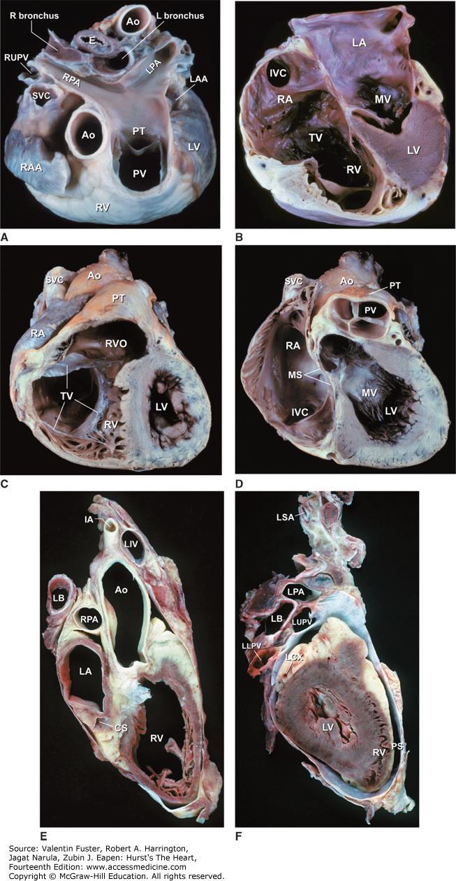 Ao, ascending aorta; CS, coronary sinus; E, esophagus; IA, innominate artery; IVC, inferior vena cava; LA, left atrium; LAA, left atrial appendage; LB, left bronchus; LCX, left circumflex coronary