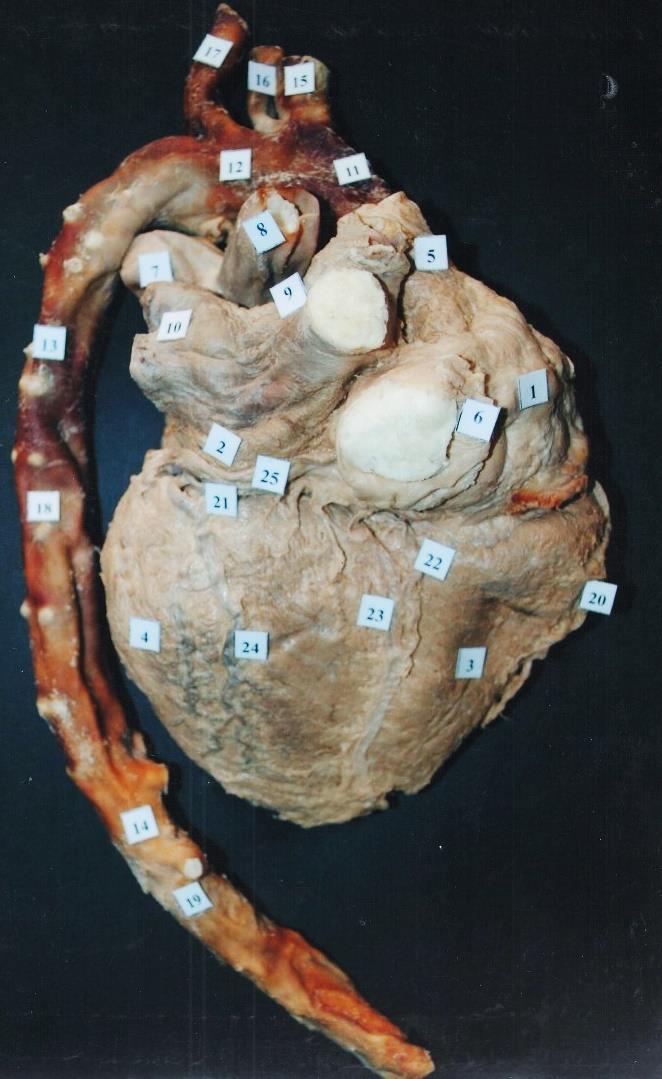 1. Atrium dextrum 2. Atrium sinistrum 3. Ventriculus dexter 4. Ventriculus sinister 5. Vena cava superior 6. Vena cava inferior 7. Arteria pulmonalis sinistra 8. Arteria pulmonalis dextra 9. Vv.