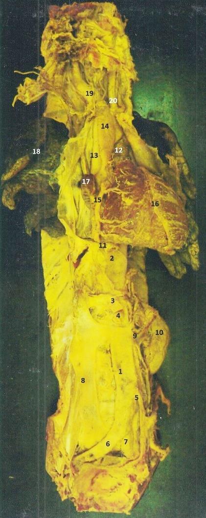 1. Aorta abdominalis 2. Aorta thoracica 3. Truncus coeliacus 4. Arteria mesenterica superior 5. Artesia mesenterica inferior 6. Arteria iliaca cimmunis dextra 7. Arteria iliaca communis sinistra 8.
