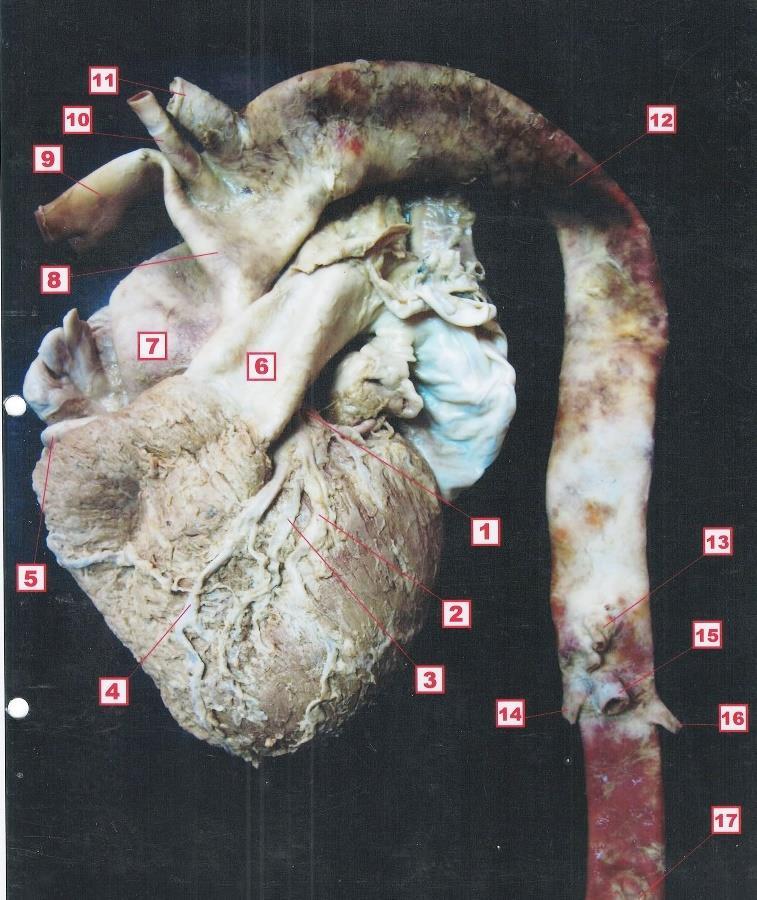 1. arteria coronaria sinistra 2. Vena cordis magna 3. Ramus interventricularis anterior; arteria coronariae sinistrae 4.