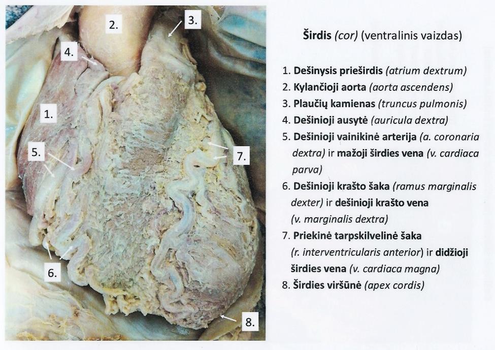RV, right ventricle; SVC,