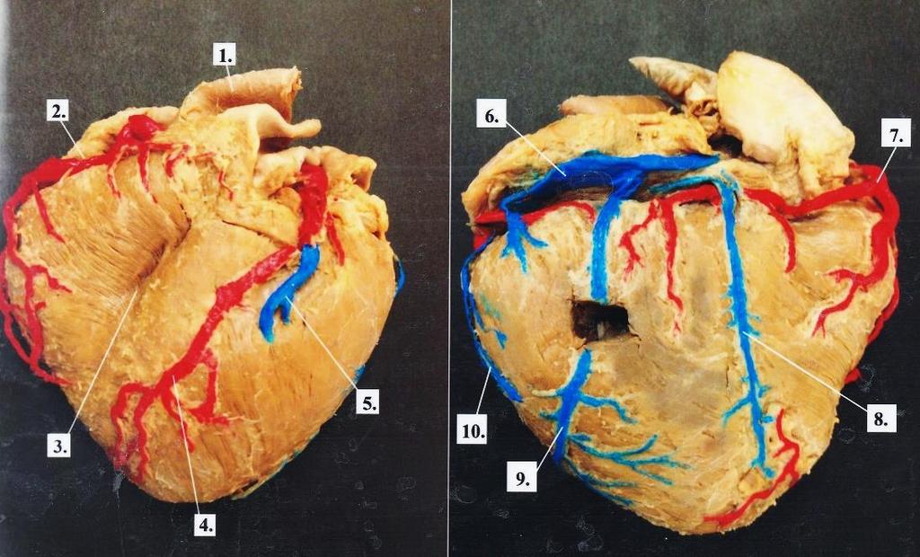 1. Aorta ascendens 2. Arteria coronaria dextra 3. Sulcus interventricularis anterior 4. Arteria coronaria sinistra 5. Vena cardiaca magna 6. Sinus coronarius 7.
