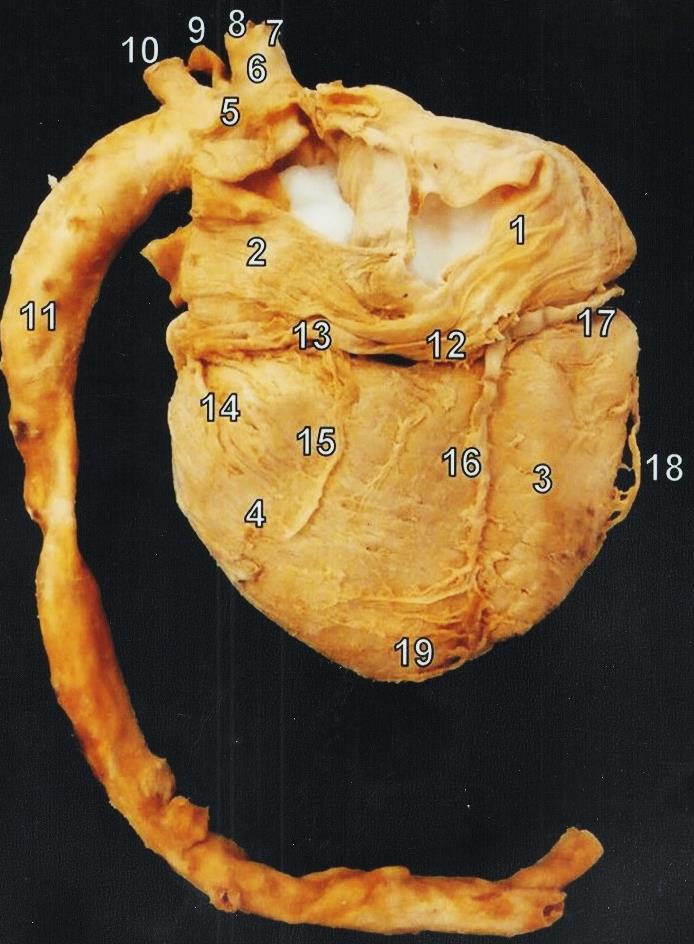 1. atrium dextrum 2. Atrium sinistrum 3. Ventriculus dexter 4. Ventriculus sinister 5. Arcus aortae 6. Truncus brachiocephalicus 7. A. subclavia dextra 8. A. carotis communis dextra 9. A. carotis communis sinistra 10.