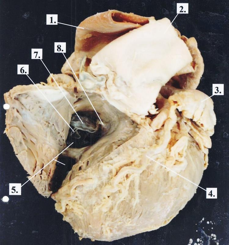 1. Aorta ascendens 2. Truncus pulmonalis 3. Arteria pulmonalis 4. Arteria coronaria sinistra 5. Ventriculus dexter 6.