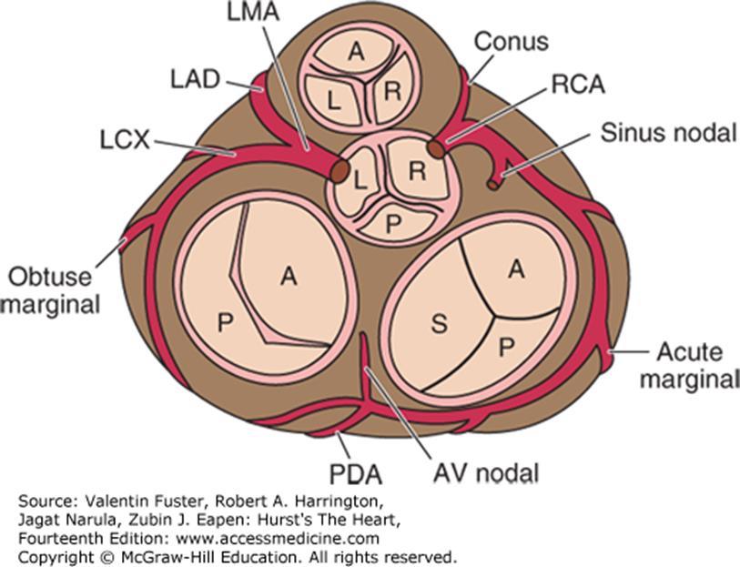 LAD, left anterior descending coronary artery; LCX, left circumflex coronary artery; LMA, left main coronary artery; OM,