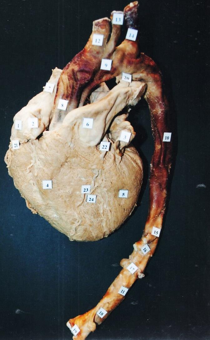 1. Atrium dextrum 2. Auricula dextra 3. Atrium sinistrum, auricula sinistra 4. Ventriculus dexter 5. Ventriculus sinister 6. Truncus pulmonalis 7. Vena cava superior 8.