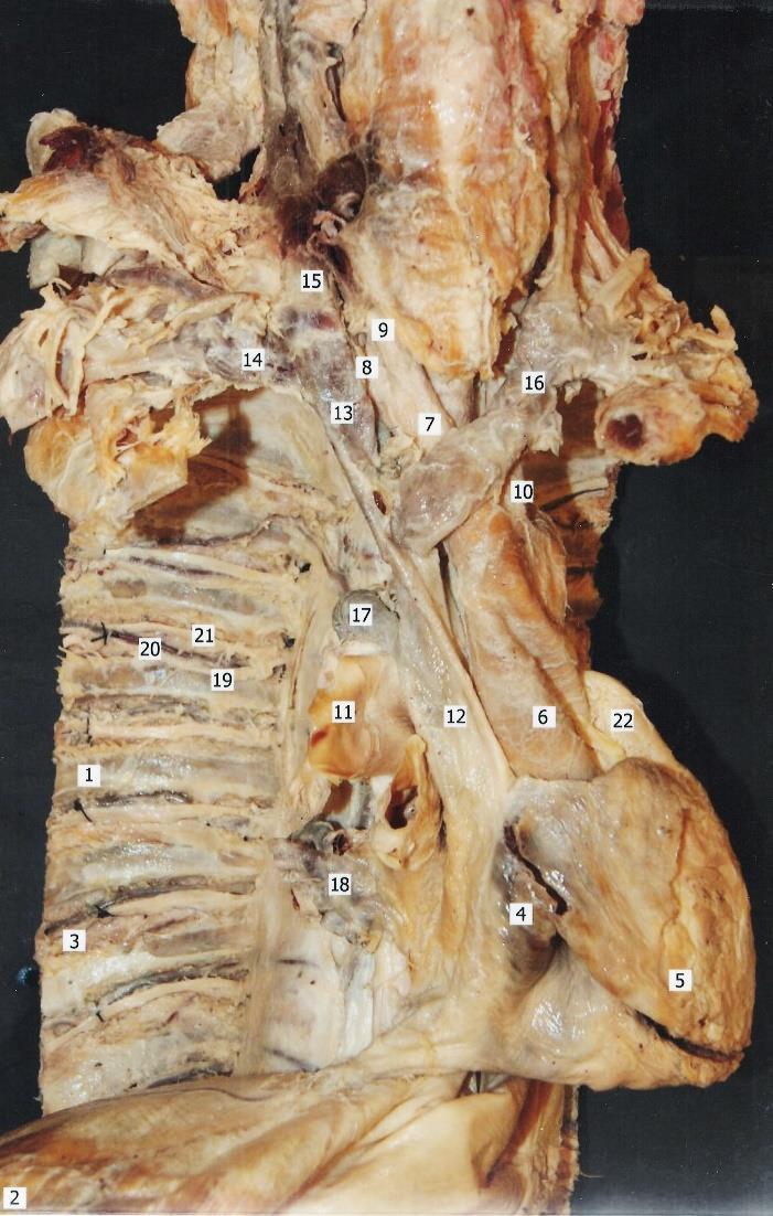 1. Costa 2. Diaphragma 3. Musculus ontercostalis internus 4. Atrium dextrum 5. Ventriculus dexter 6. Aorta 7. Truncus brachiocephalicus 8. Arteria subclavia dextra 9.