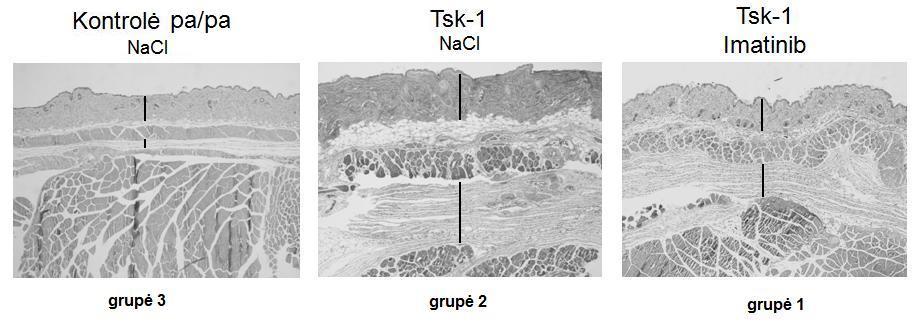 18 pav. Eksperimentinio Tsk-1 mutacijos modelio, kiekvienos grupės reprezentatyvios nuotraukos, atspindinčios odos ir poodžio fibrozę. (odos ir poodžio storis pažymėtas vertikaliomis linijomis).