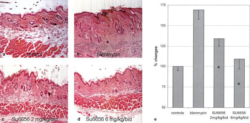 35 pav. Bleomicino sukeltos odos fibrozės prevencija Src kinazių inhibitoriumi SU6656. SU6656 slopino ELM akumuliacija nuo dozės priklausomai.