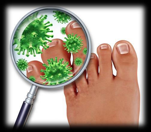 Kojų higiena I Kojų odoje yra daug prakaito liaukų, todėl jos, ypač kai šilta, prakaituoja ir užsiteršia. Nešvarių kojų tarpupirščiai greičiau iššunta ir įskyla.