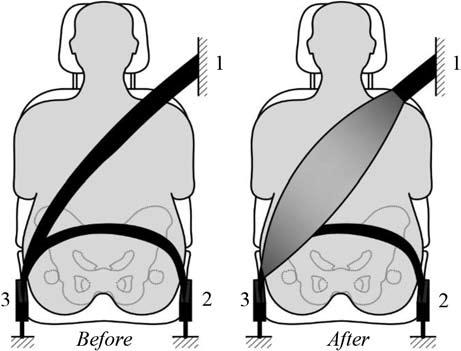 vii) Use a seat with a higher lumbar backrest Beltin-Seat Design (providing different positions for adjusting the head restraint), with the aim of improving anthropometric positioning and its