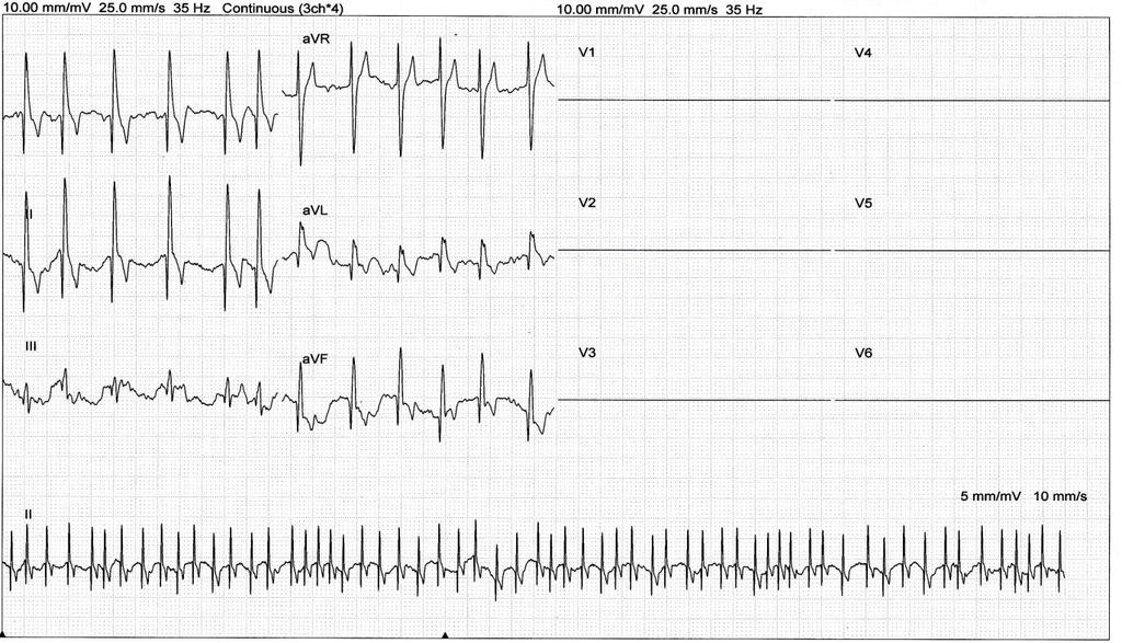 5 priedas. EKG pavyzdys Bokseris, patinas, 6 m., 41,6 kg.