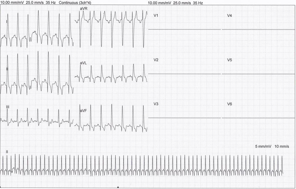 9 priedas. EKG pavyzdys Amerikiečių Stafordšyro terjeras, patinas, 10 m.