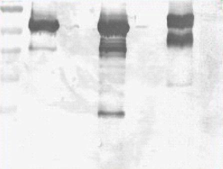 55 kda 43 kda Viršuje: bendrų ląstelės baltymų SDS-PAGE Coomasie, Apačioje: Western