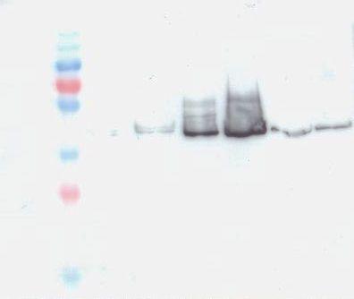 Viršuje: bendrų ląstelės baltymų SDS- PAGE Coomassie, Apačioje: Western hibridizacija su anti-6his Mab.