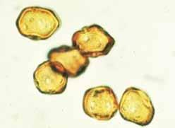 109 pav. Kriaušinė gleivėtrūdė (Gymnosporangium sabinae): eciosporos (iš http://homepage.swissonline.