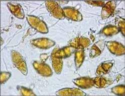 q=gymnosporangium+sa binae&tbm=isch&tbo=u&so urce=univ&sa=x&ei=romdu v3vjaan4gsopihwaw&ved= 0CC4QsAQ&biw=1366&bih=