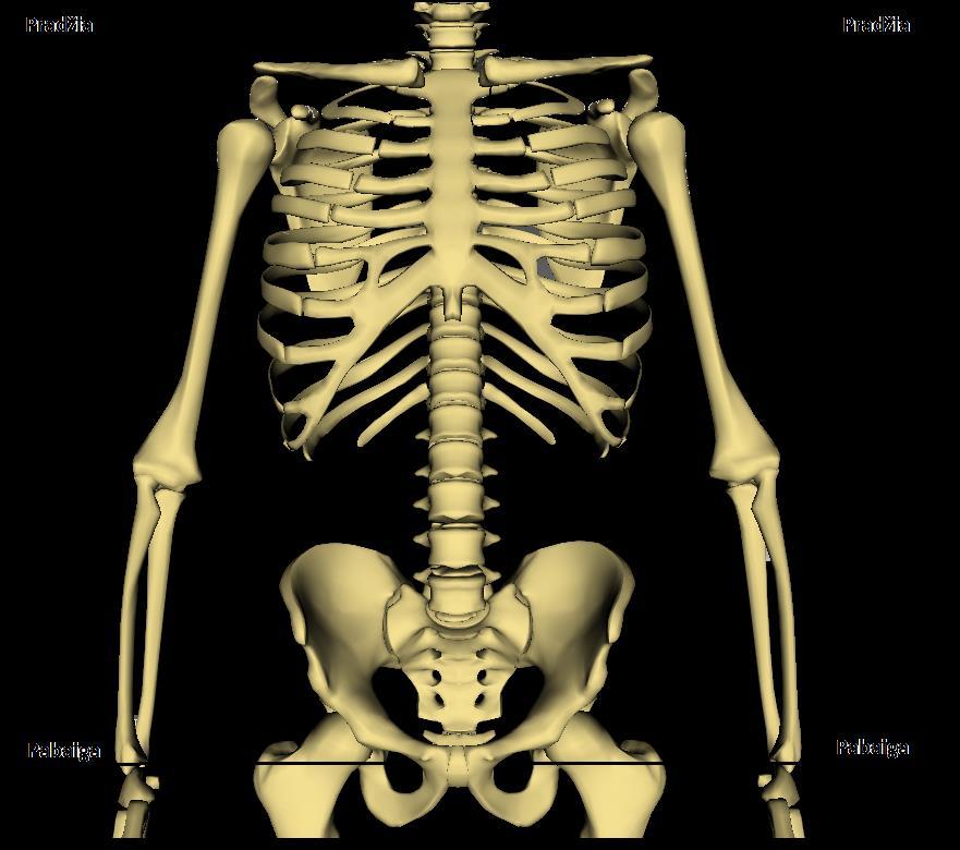 VIDAUS ORGANŲ, KRAUJAGYSLIŲ, ŠONKAULIŲ IR STUBURO 3D REKONSTRUKCIJA Paciento kojos ištiestos lygiagrečiai tomografo stalui Centrinė veido linija turi sutapti su sagitaline plokštuma Delnai pasukti į