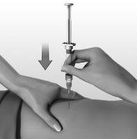Leiskite odai nudžiūti. Viena ranka patempkite odą aplink injekcijos vietą. Atpalaiduokite raumenis.